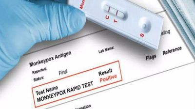 ಮಂಕಿ ಫಾಕ್ಸ್‌ಗಾಗಿ ಸ್ವದೇಶಿ RT-PCR ಪರೀಕ್ಷಾ ಕಿಟ್ ಅನ್ನು ಅಭಿವೃದ್ಧಿಪಡಿಸಿದ ಭಾರತ