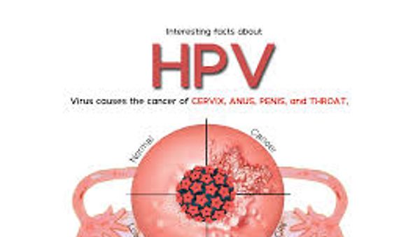 ಎಚ್‌ಪಿವಿ (HPV) ಸೋಂಕಿತರ ಸಂಖ್ಯೆಯಲ್ಲಿ ಭಾರತಕ್ಕೆ ವಿಶ್ವದಲ್ಲೇ 2ನೇ ಸ್ಥಾನ