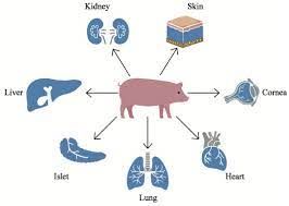 ಕ್ಸೆನೋ ಕಸಿ (Xenotransplantation)