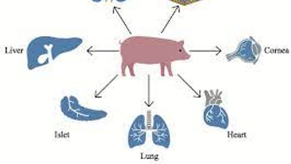ಕ್ಸೆನೋ ಕಸಿ (Xenotransplantation)
