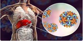 2024ರ ಜಾಗತಿಕ ಹೆಪಟೈಟಿಸ್ ವರದಿ ಬಿಡುಗಡೆ ಭಾರತಕ್ಕೆ 2ನೇ ಸ್ಥಾನ